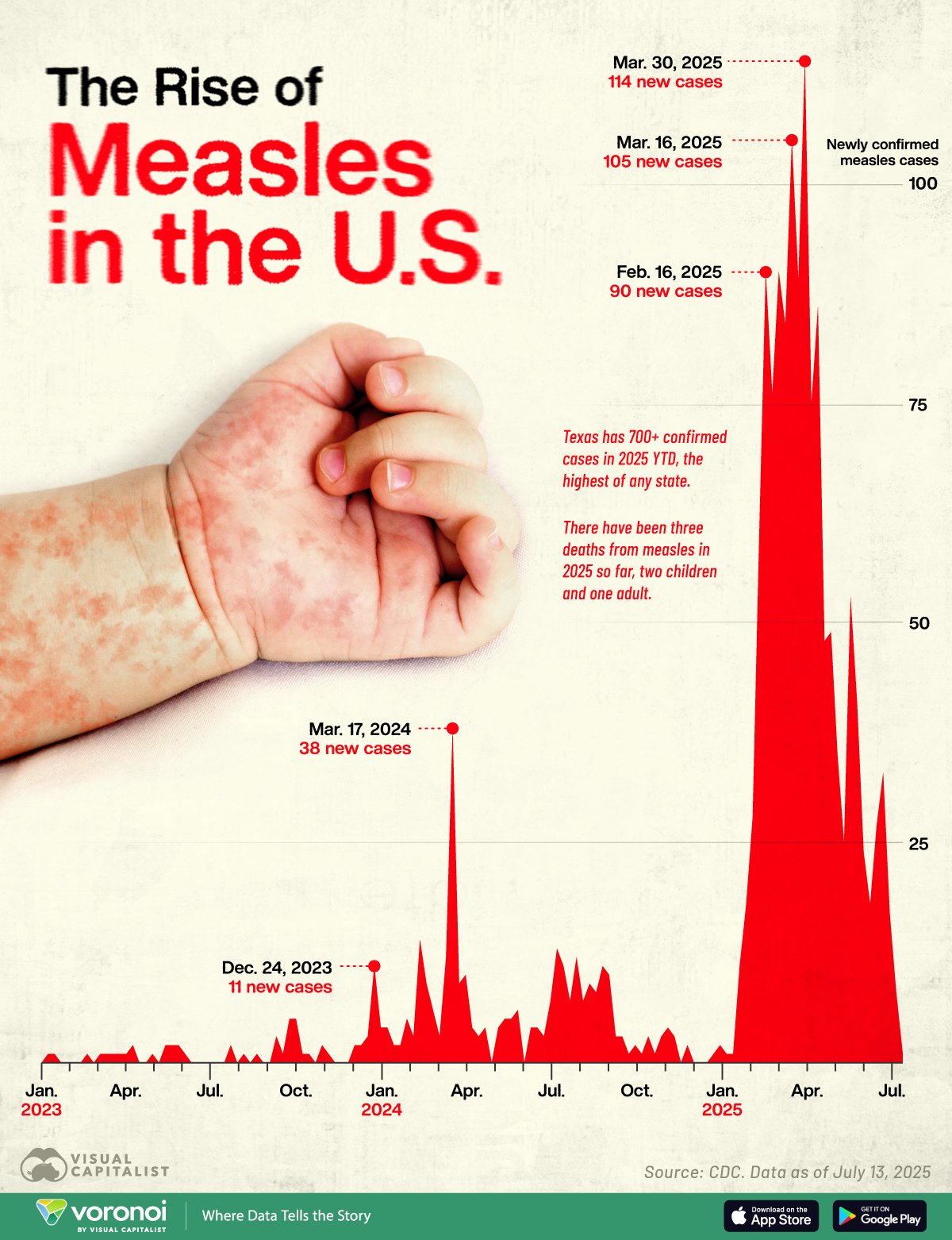 Chart of measles cases in the U.S. from 2023 to 2025