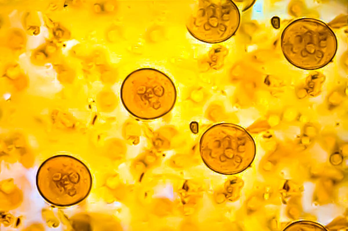 Seven wells tested in Murphy’s study were found to have had cryptosporidium, the protozoan parasite shown here, at some point. Photo: Md Ariful Islam/iStock/Getty Images