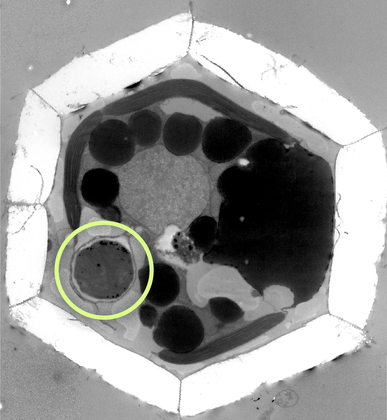 A transmission electron microscope image of a hexagonal microbe, with a circle highlighting a part of the cell.